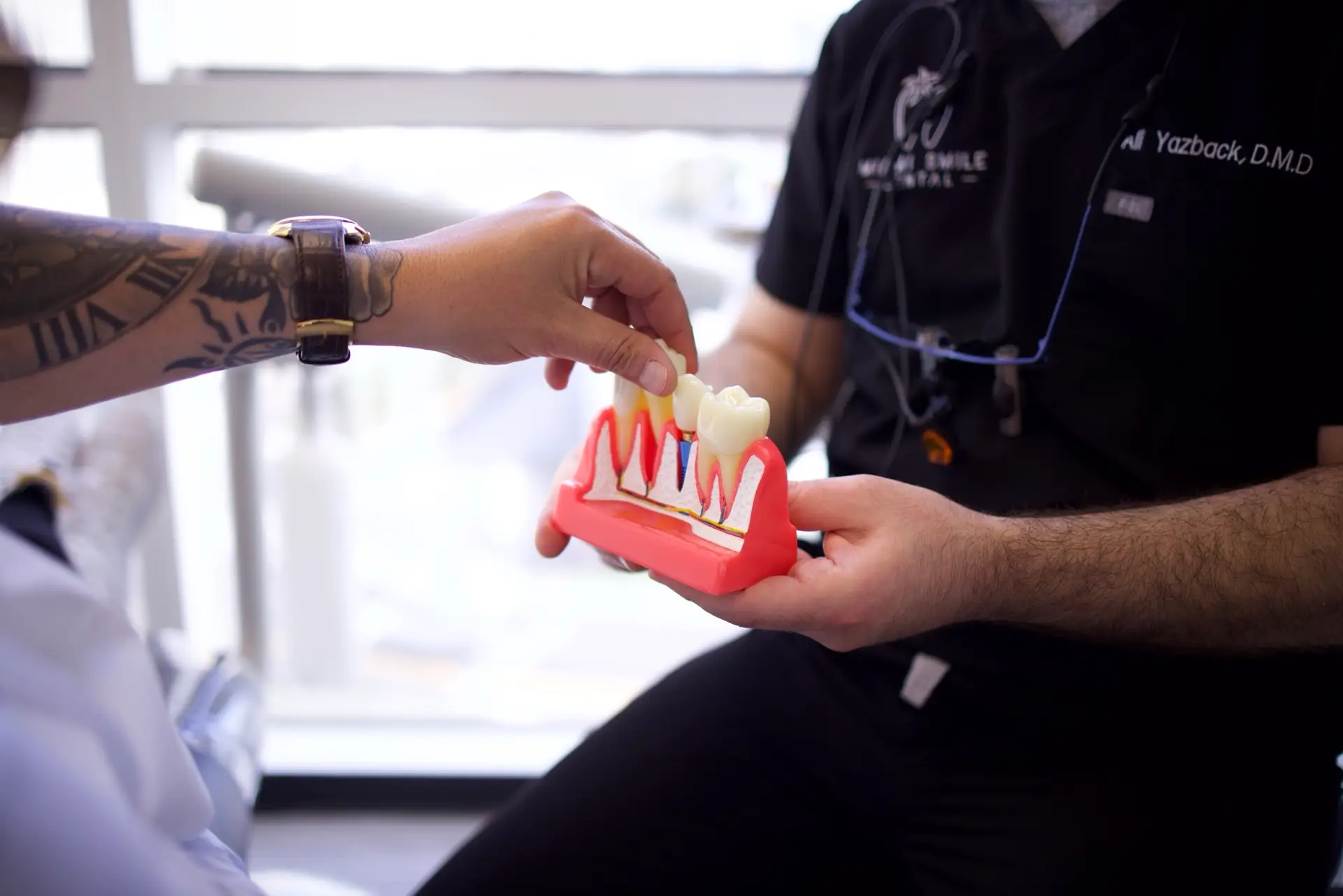 Implants dentaires